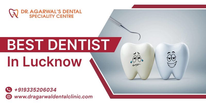 Best Orthodontic Treatment in Lucknow 