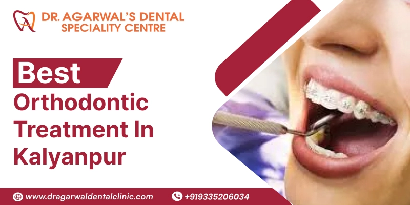  Best Orthodontic Treatment in  Kalyanpur 