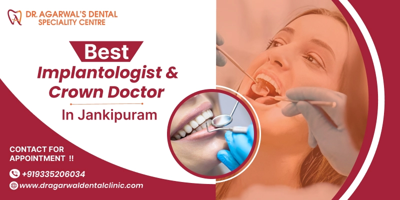 Best implantologist & crown doctor in Jankipuram
