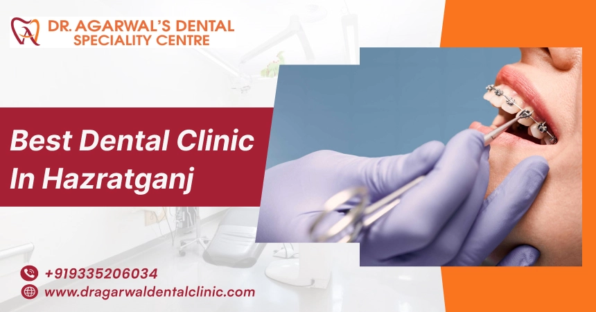Dental Clinic in Hazratganj