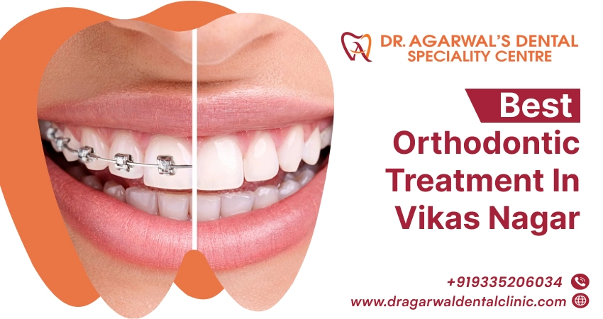 best-orthodontic-treatment-in-vikas-nagar
