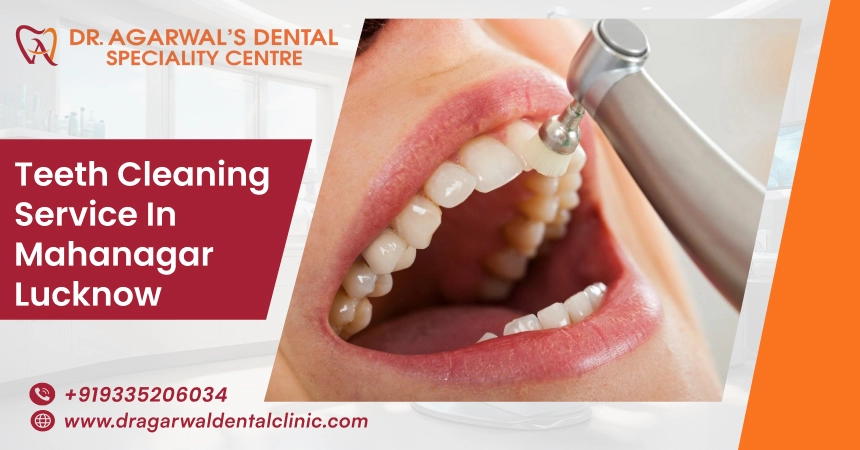 teeth cleaning services in mahanagar lucknow